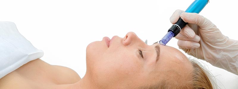 Mezoterapia Lublin